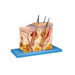 مولاژ پوست پلکانی