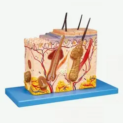 مولاژ پوست پلکانی