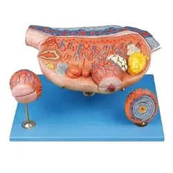 مولاژ تخمدان