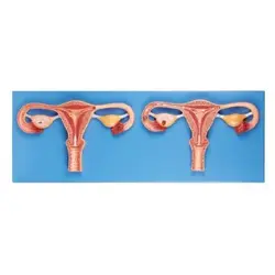 مولاژ شبیه ساز عمل لقاح