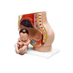 مولاژ لگن رحم در نهمین ماه بارداری