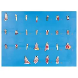 مولاژ مدل بیماری ها و امراض درمانی