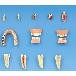 مولاژ مدل بیماری و امراض درمانی