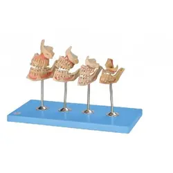 مولاژ مدل پیشرفته دندان و فک