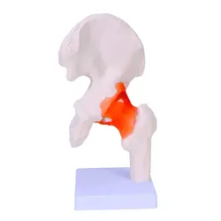 مولاژ مفصل ران با نمایش رباط ها