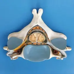 مولاژ مهره 5 گردن