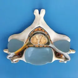 مولاژ مهره پنجم گردن