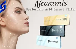 ژل فیلر نورامیس