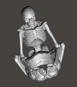 اسکلت گودال