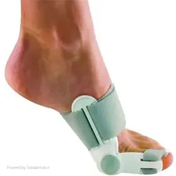 آتل اصلاح کننده هالوکس والگوس
