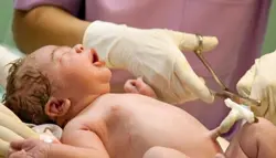 کلمپ بند ناف برند بکر