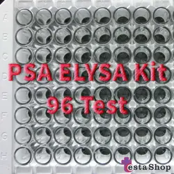 کیت تشخیص سرطان پروستات | کیت PSA | آزمایش سرطان پرستات