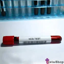 کیت تشخیص باروری بتا hCG الایزا