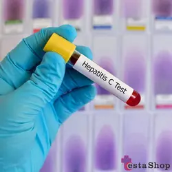 کیت تشخیص هپاتیت سی HCV الایزا