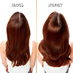 شامپو روغن تراپی پنتن ۴۰۰ میل