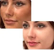 سرم روشن کننده پوست تراست مدل ویتامین سی Trust Vitamin C
