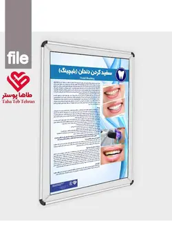 پوستر سفید کردن دندان (بلیچینگ)- مجموعه پوسترهای دندانپزشکی (آموزش بیمار)