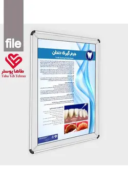 پوستر جرم گیری دندان - مجموعه پوسترهای دندانپزشکی (آموزش بیمار)