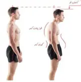 قوزبند آتل دار نئوپرن طبی اپتو( پارساطب)