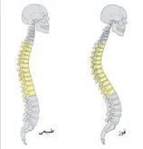 قوزبند آتل دار نئوپرن طبی اپتو( پارساطب)