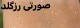 هایلایتر پودری کاملا درخشان با ماندگاری بالا