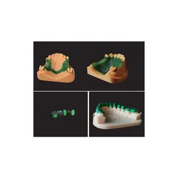 رزین ریخته گری دندان ونشیپ مدل Casting LCD 1KG برند Vanshape