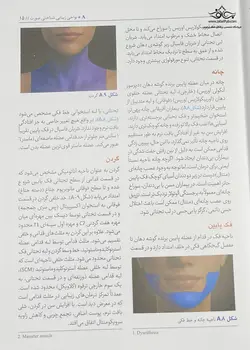 تزریق فیلر برای هارمونی صورت - نوابوک