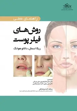 راهنمای عملی روش های فیلر پوست - نوابوک