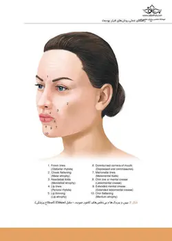 راهنمای عملی روش های فیلر پوست - نوابوک