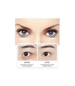 کرم ترمیم کننده خاویار دور چشم نیاسین آمید ونزن 20 گرم