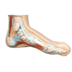 مولاژ کف پای سالم و بیمار