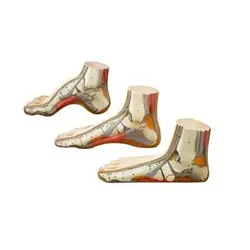 مولاژ کف پای سالم و بیمار