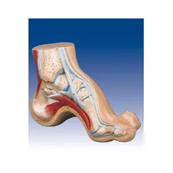 مولاژ کف پای سالم و بیمار