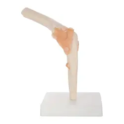 مولاژ مفصل آرنج مدل XC-112