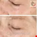 کرم صورت لایه بردار سه گانه فیزیکی شیمیایی آنزیمی Murad - Vita-C Triple Exfoliating Facial 80 ml