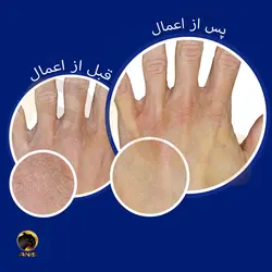 کرم مرطوب کننده دست نوتروژینا neutrogena حاوی گلیسیرین آبی حجم 50 میل | فروشگاه انیس تجارت