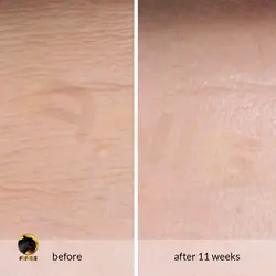 سرم ضد چروک Anti Wrinkle آون حاوی رتینول 30 میل | فروشگاه انیس تجارت