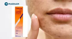 کرم کلوبیوت اصل پاکستانی (کلوبتازول اصل نارنجی رنگ) ، خرید کرم کلوبیت اصل20g