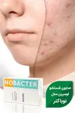 صابون نوباکتر NOBACTER اصل فرانسوی مدل اوسرین وزن 100 گرم