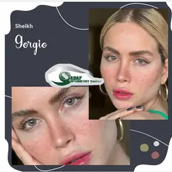 لنز طبی رنگی برند sheikh (شیخ)