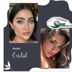 لنز طبی رنگی برند sheikh (شیخ)