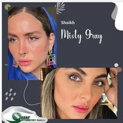 لنز طبی رنگی برند sheikh (شیخ)