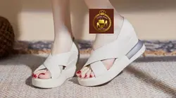 صندل لژدار طبی تابستانی زنانه مرسانا