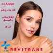 فیلر رویترین کلاسیک تک سی سی | Revitrain Classic