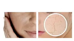 پک ویال ویتامین  C ایمجز