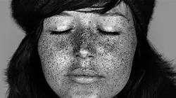 اسپری رفع آفتاب سوختگی و عرق سوز