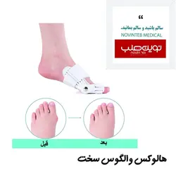 اسپلینت هالوکس والگوس سخت اوتک