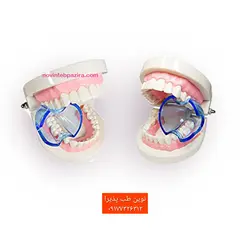 دهان بازکن خلفی (toothis (posterior - فروشگاه اینترنتی مواد و تجهیزات دندانپزشکی نوین طب پذیرادهان بازکن خلفی (toothis (posterior