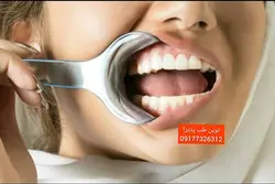 دهان بازکن یک طرفه اطفال Maquira - فروشگاه اینترنتی مواد و تجهیزات دندانپزشکی نوین طب پذیرا