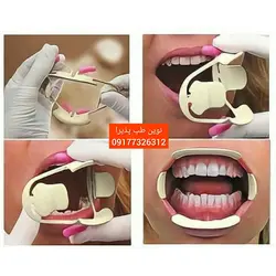 دهان بازکن Kerr - فروشگاه اینترنتی مواد و تجهیزات دندانپزشکی نوین طب پذیرا